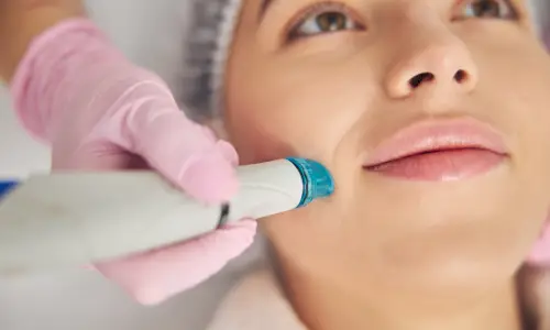 Hydrafacial for Acne-Prone Skin | Plastic Surgery India