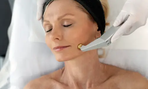 Anti-ageing Laser Treatment | Plastic Surgery India