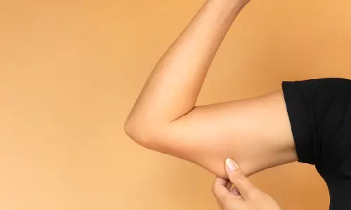  Arm Lift (Brachioplasty) | Plastic Surgery Indian