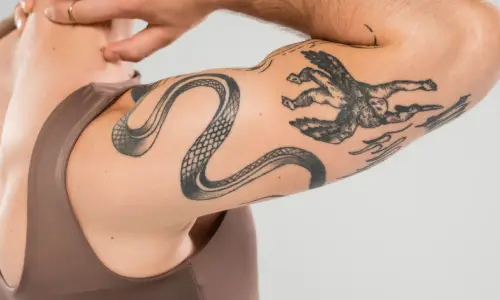 Black Ink Tattoo Removal | Plastic Surgery India