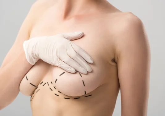 Breast Lift | Plastic Surgery Indian