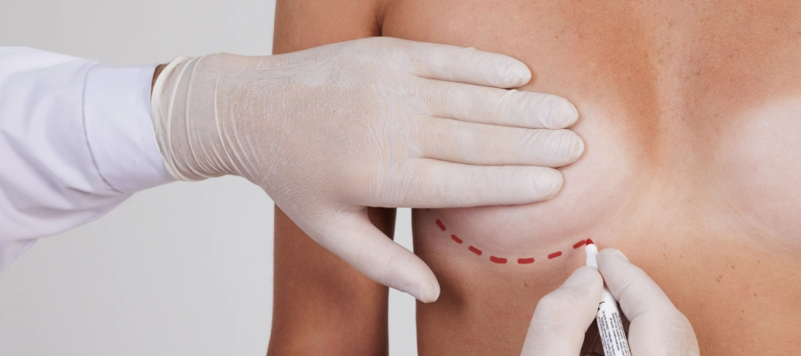 Breast Surgery | Plastic Surgery Indian