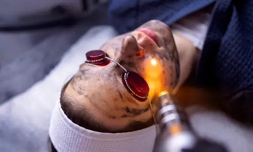 CO₂ laser resurfacing | Plastic Surgery India