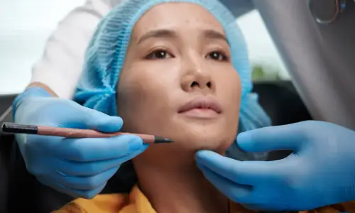 Cheek Fillers | Plastic Surgery Indian