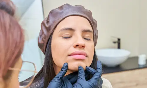 Chin Fillers | Plastic Surgery Indian