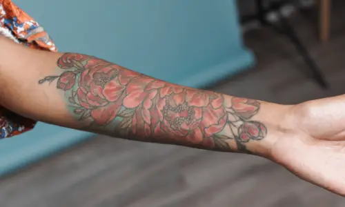 Colour Tattoo Removal | Plastic Surgery India