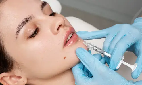Dermal Fillers