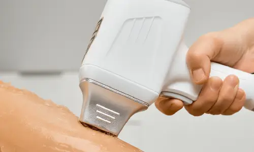 Diode Laser Hair Removal | Plastic Surgery India