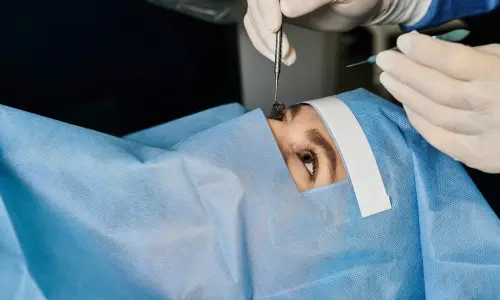 Eyelid Rejuvenation Surgery | Plastic Surgery Indian