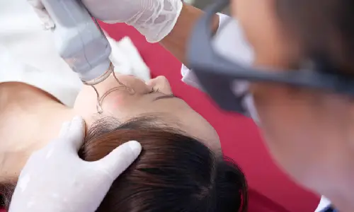 Fractional laser treatment | Plastic Surgery India