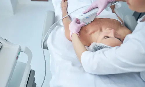 HIFU for Body | Plastic Surgery India