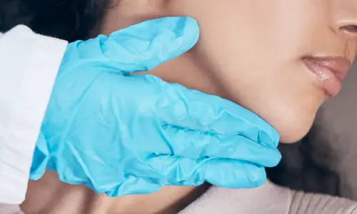 Jawline Fillers | Plastic Surgery Indian