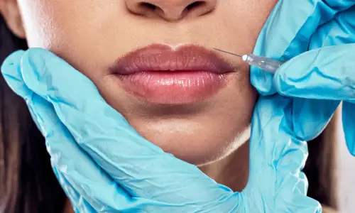 Lip Fillers | Plastic Surgery Indian