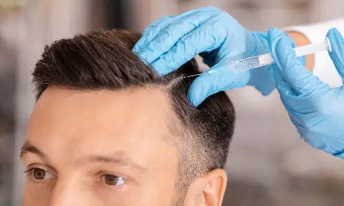 PRP for Hair Loss | Plastic Surgery India