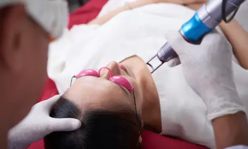 Pigmentation Laser Treatment | Plastic Surgery India