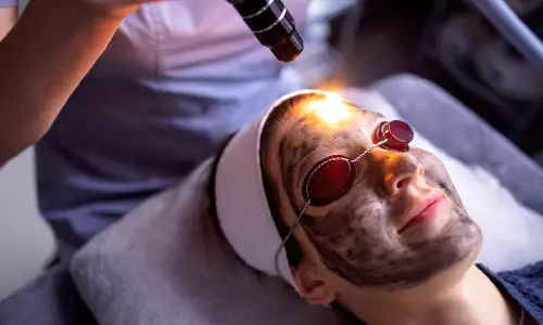 Pigmentation removal treatment | Plastic Surgery India