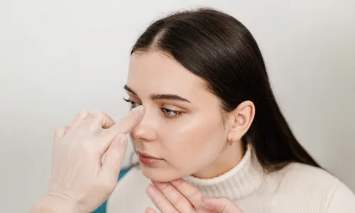 When do you need a Rhinoplasty (Nose Surgery)? | Plastic Surgery Indian