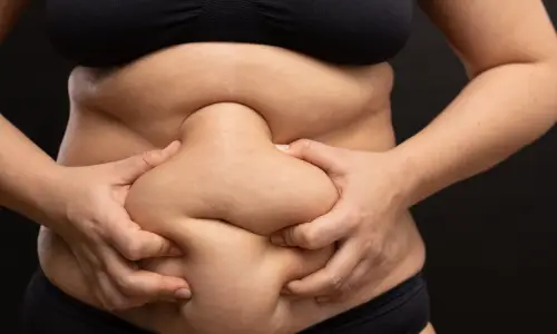 Tummy Tuck (Abdominoplasty) | Plastic Surgery Indian