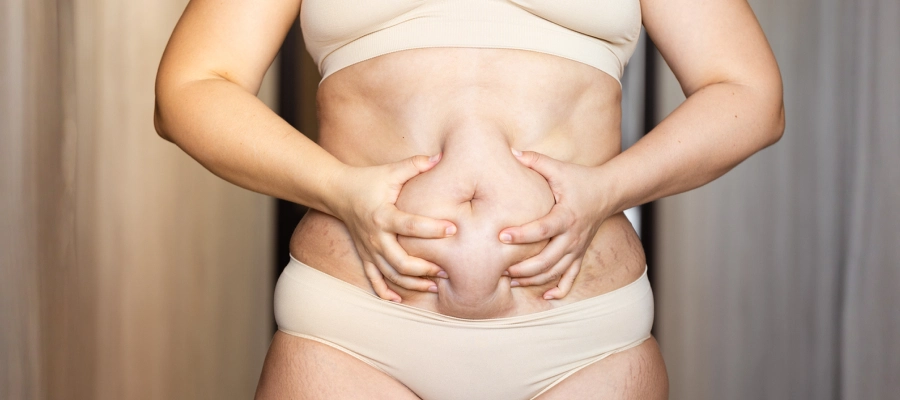 Tummy Tuck Surgery | Plastic Surgery Indian 