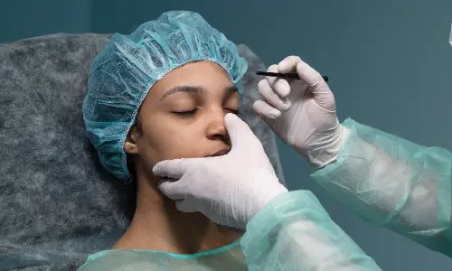 Upper Eyelid Surgery | Plastic Surgery Indian