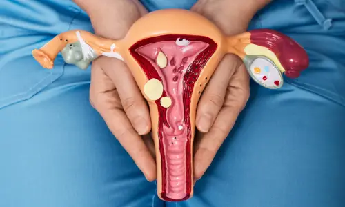 Vaginal Tightening Surgery | Plastic Surgery India