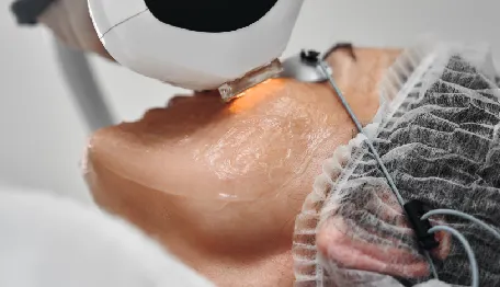 Laser Skin Resurfacing