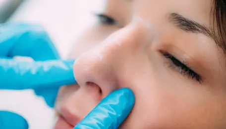 Rhinoplasty