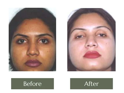 Cream Programme, Dr. Manoj Khanna