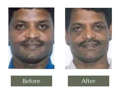 Cream Programme, Dr. Manoj Khanna