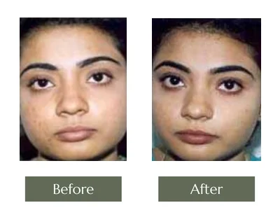 Cream Programme, Dr. Manoj Khanna