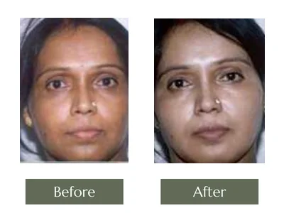Cream Programme, Dr. Manoj Khanna