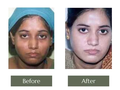 Cream Programme, Dr. Manoj Khanna