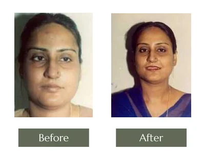 Cream Programme, Dr. Manoj Khanna