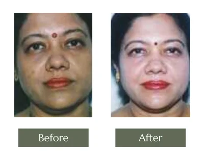 Cream Programme, Dr. Manoj Khanna