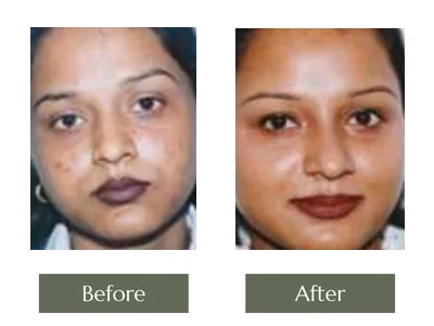 Cream Programme, Dr. Manoj Khanna