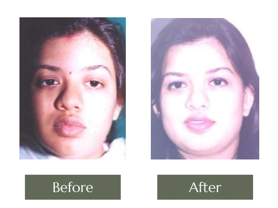 Eye & Lip Surgery, Dr. Manoj Khanna