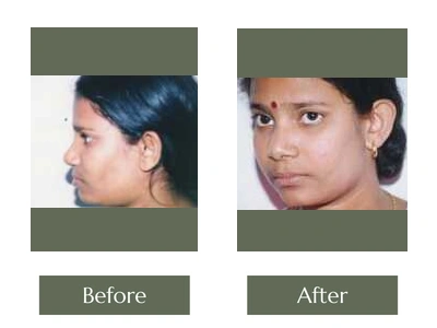 Eye & Lip Surgery, Dr. Manoj Khanna