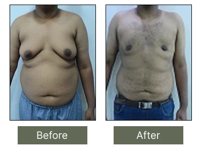 Transformation
