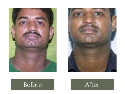 Miscellaneous, Dr. Manoj Khanna