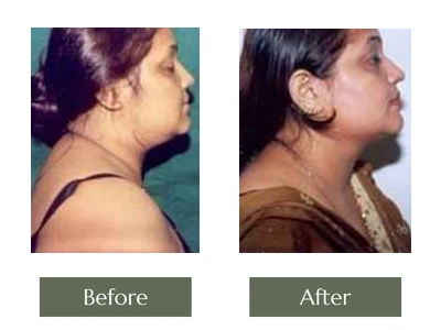 Miscellaneous, Dr. Manoj Khanna