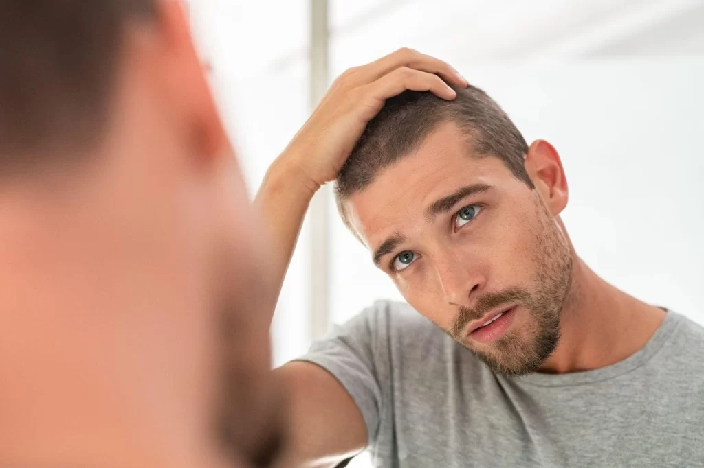 Hair Transplant Recovery Timeline
