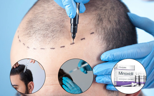 Hair Transplant