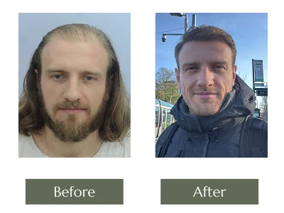 Transformation